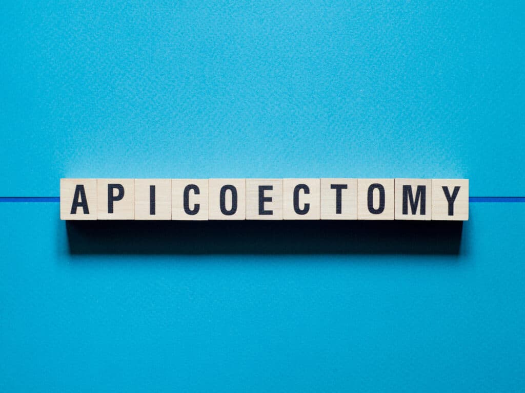 apicoectomy by endosd by summerville sc